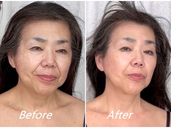 ドクターボディ 新宿店(Dr.Body)/【首長/フェイスライン 50代】