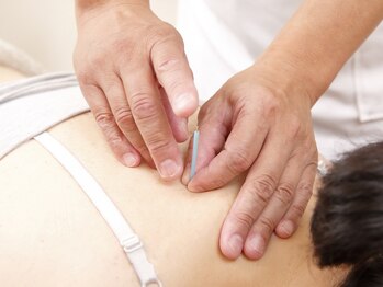 ケイトリート鍼灸マッサージ院/初めての鍼でも☆