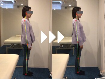 ミライズ整体院 三宮本院/事例【40代男性・姿勢】