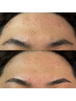 アレス 錦糸町店(Ares)/メンズ眉毛専門店Ares眉サロン