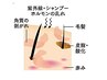 【敏感頭皮ケア】　フケ・かゆみ集中改善コース ¥25,000→¥9,800