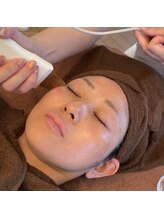 ナオフクオカ ヒーリングフォースエヌ(NaoFukuoka/healingforceN)/乳酸とアルカリ美容液で角質除去