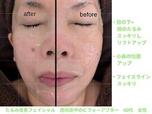 ビューティサロン オハナ(ohana)の雰囲気（たるみケア/小顔/ピーリング/フェイシャル/リンパマッサージ千葉）