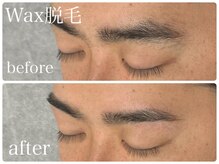 フルミー(fulme.)/WAX脱毛before＆after