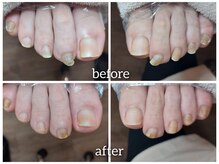 爪切り屋 足楽/【届かない足の爪】