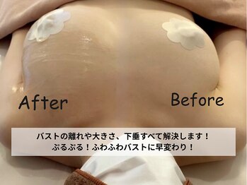 リ ビューティ リバティ(Re:Beauty LIBERTY)の写真/バストの位置そこで合ってますか?バストのあらゆる悩み当サロンで徹底的に解決します。