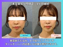 晴々の雰囲気（20代女性の変化！顔のむくみ、バランスが良くなっています！！）