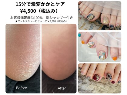 えぴねいるの写真