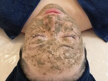 シュエマ(CHOUEMA)/［最先端NMNハーブピーリング］