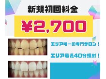 ホワイトニングサロン アース 福知山店(EARTH)