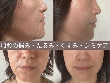 エメ 心斎橋(Aimer)の写真