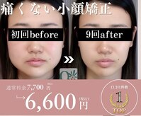 小顔矯正専門サロンQpu下関店【キュープ】