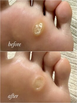 リゼラアンドコー 布施店/