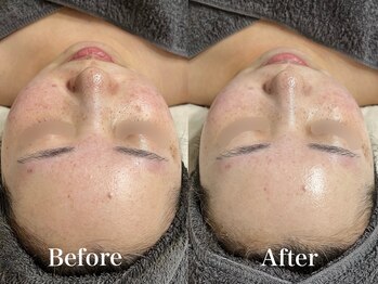 マシェ バイ マユ(Mache by Mayu)/急な予定の一週間前に。