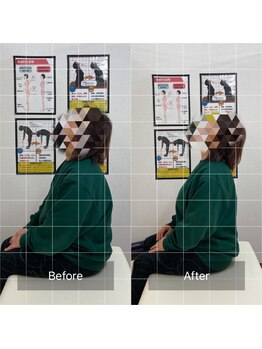 ナオル整体 福島院(naoru整体)/50代女性