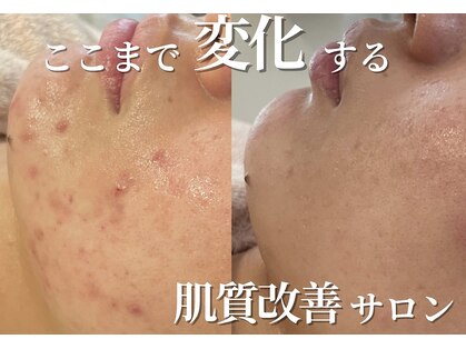 エトレ(etre)の写真