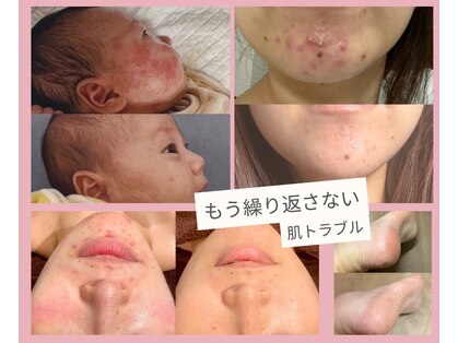 アティロン(Attirant)の写真