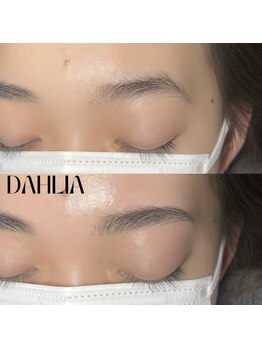 ダリア(Dahlia)/眉毛のワックスで脱毛
