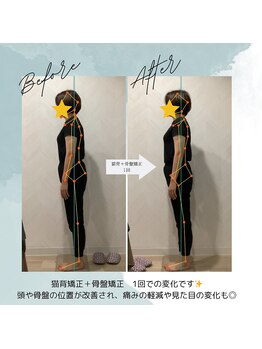 ラクリエ 東加古川院(La Creer)/お客様ビフォーアフター