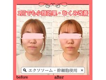 ソエルテ(soerute)の雰囲気（【小顔筋膜リリース】頭から丁寧にほぐしてお顔スッキリ♪）