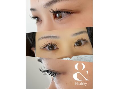 ブルーム(bloom)の写真