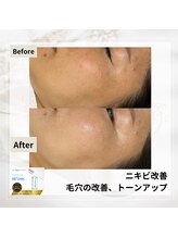 ルアナ(Luana)/セラピールの効果★