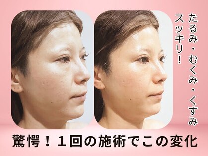 グレースフィオーレ 南越谷店(gracefiore)の写真