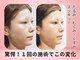 グレースフィオーレ 南越谷店(gracefiore)の写真