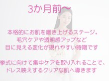 チッチ アフロディーテ(Chicchi Aphrodit)/ブライダルエステの通い方