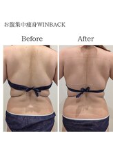 セルノヴァ(Cell Nova)/お腹/痩身/痩身ダイエット