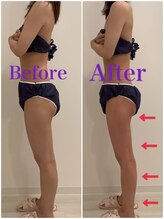 スペチアーレ 夙川/スッキリ脚長