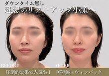 ミプラス鍼灸(MePlus鍼灸)