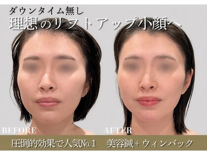 ミプラス鍼灸スタジオの写真