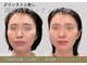 ミプラス鍼灸スタジオの写真