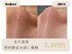 サロン アンネ(Anne)の写真/繰り返すニキビやザラつき毛穴といちご鼻を丁寧にケア!理想のなめらか肌を目指す旅♪