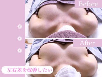キアナ 横浜店(Kiana)/左右差にお悩みの方Before After