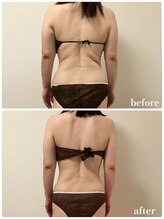 リリィブラン(Lily branc)/【痩身】上半身背面