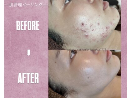 アイリス(AIRIS)の写真