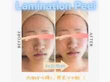 フィル 名駅店(fil)/Laminationpeel