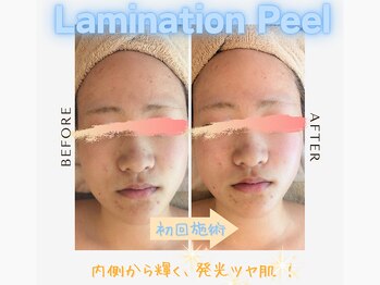 フィル 名駅店(fil)/Laminationpeel