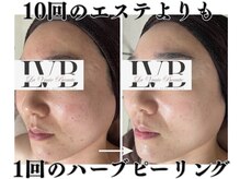虜になる方続出！リピートしたくなる感動の結果力◎\11,000～