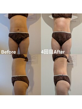 サロン ド モミカル(salon de momikaru)/