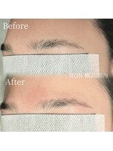 サロンロン 横浜関内(SALON RON)/眉毛/美容電気脱毛