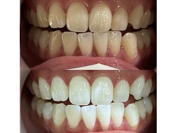 サロンエル(SALON el)/◇医療提携ホワイトニング◇