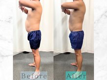 パラディ(PARADIS)/ボディコルギ