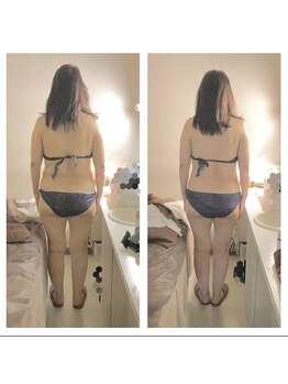 アクア エステティコ 亀有(ACQUA estetico)/中半身 半年変化 50代
