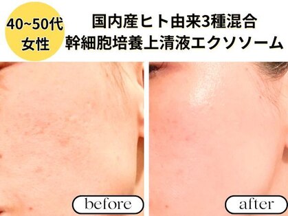 リジェネラティブセル メディカルサロン(Regenerative Cell Medical Salon)の写真