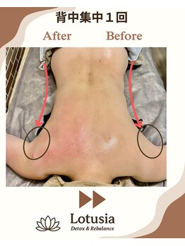 ルトゥーシア(Lotusia)/背中　before→after