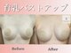 レミュ(Remu)の写真