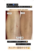 ルミエール(LUMIERU)/